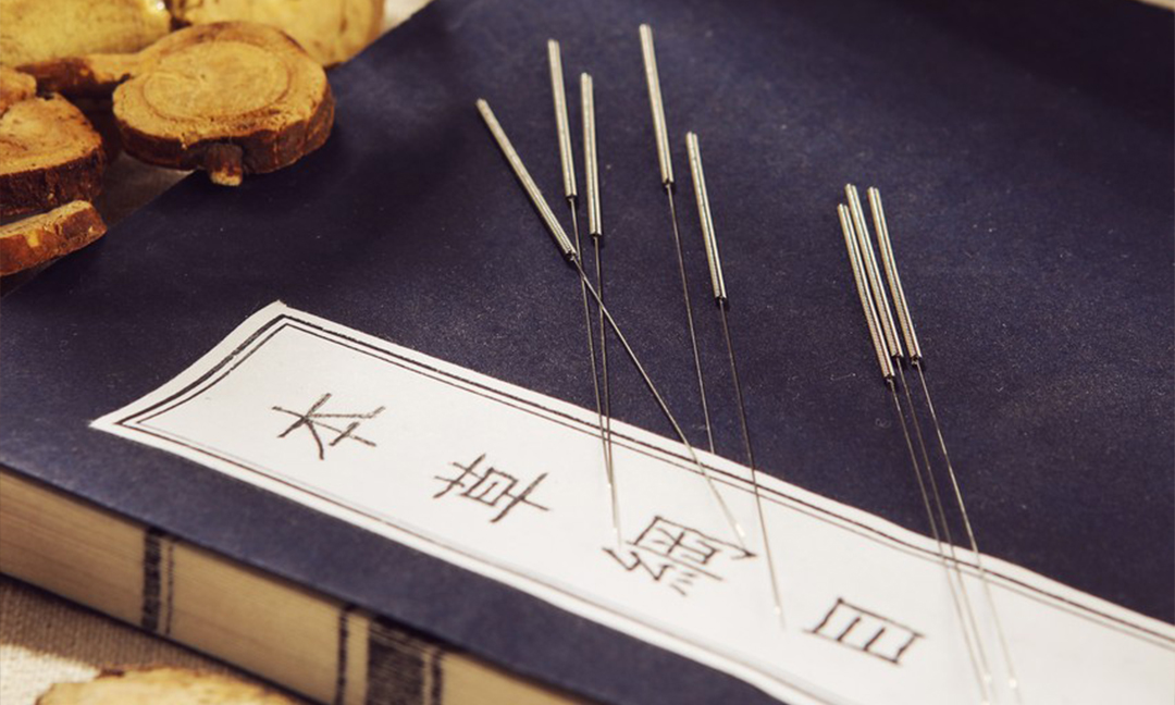 Acupuncture, what is the difference between 