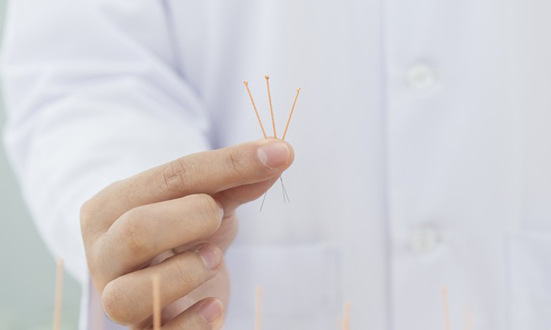 Acupuncture can cure diseases by inserting needle...